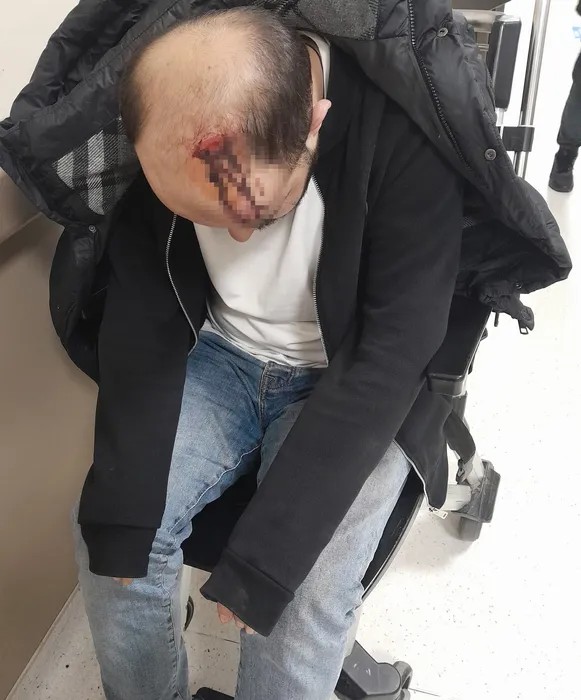 24 Milyonluk Borç Kabusa Dönüştü! Mafya Aracılığıyla Darp Ve Tehdit